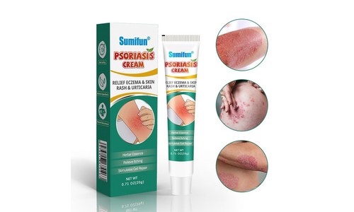 캠핑 벌레 물린 후 연고 가성비 순위 구매가이드